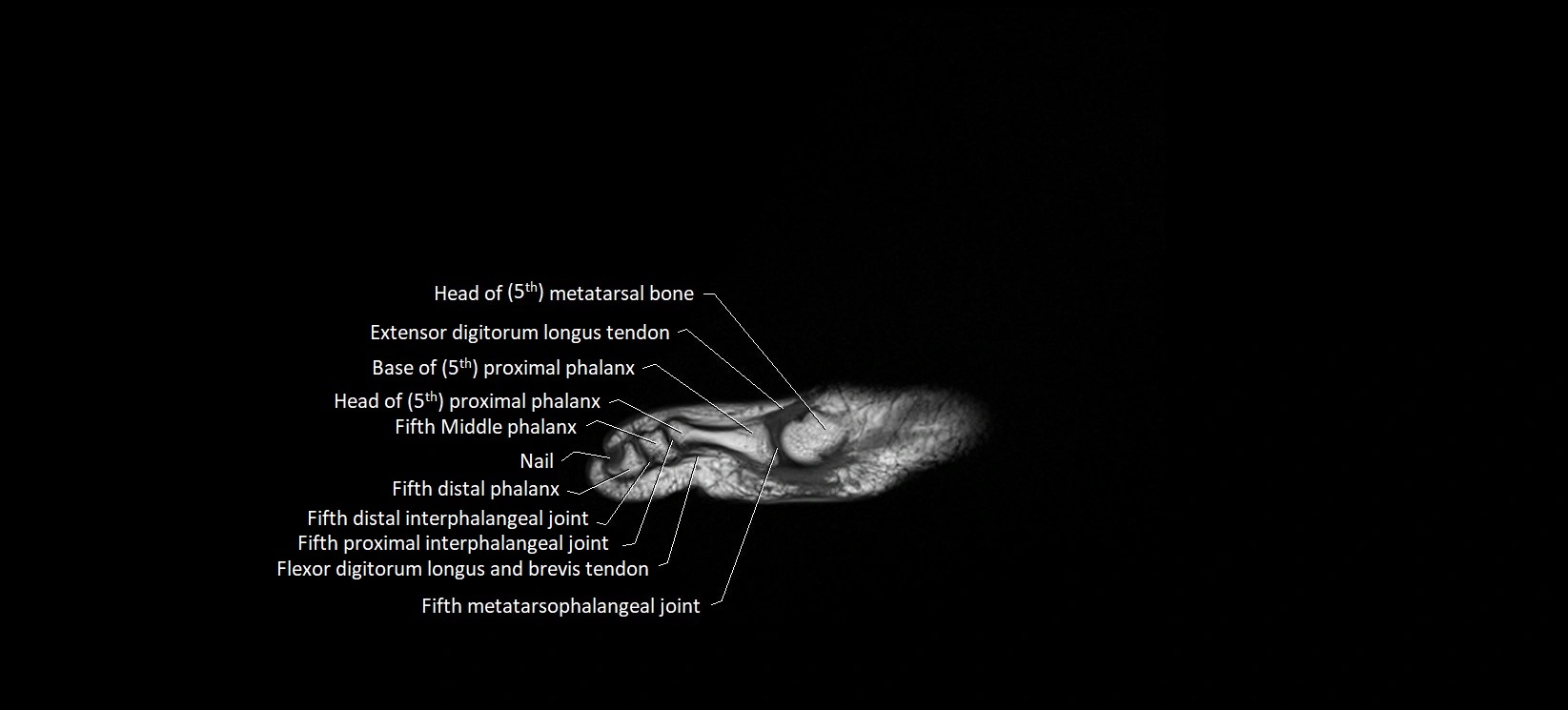 MRI foot sagittal labelled cross sectional anatomy image  25.webp